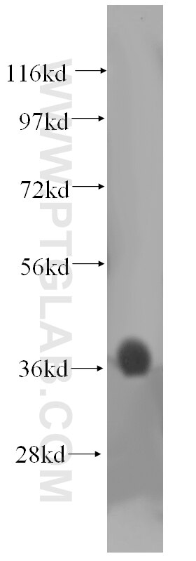 PHYHIP