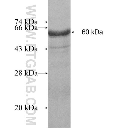 PHYHIP fusion protein Ag10575 SDS-PAGE