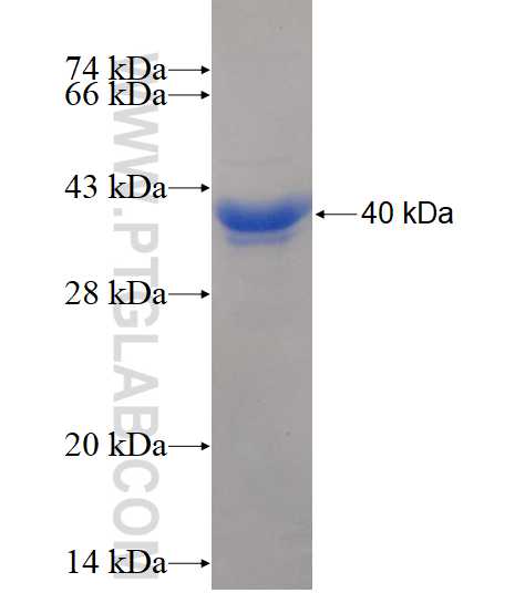 PHYHIP fusion protein Ag10837 SDS-PAGE
