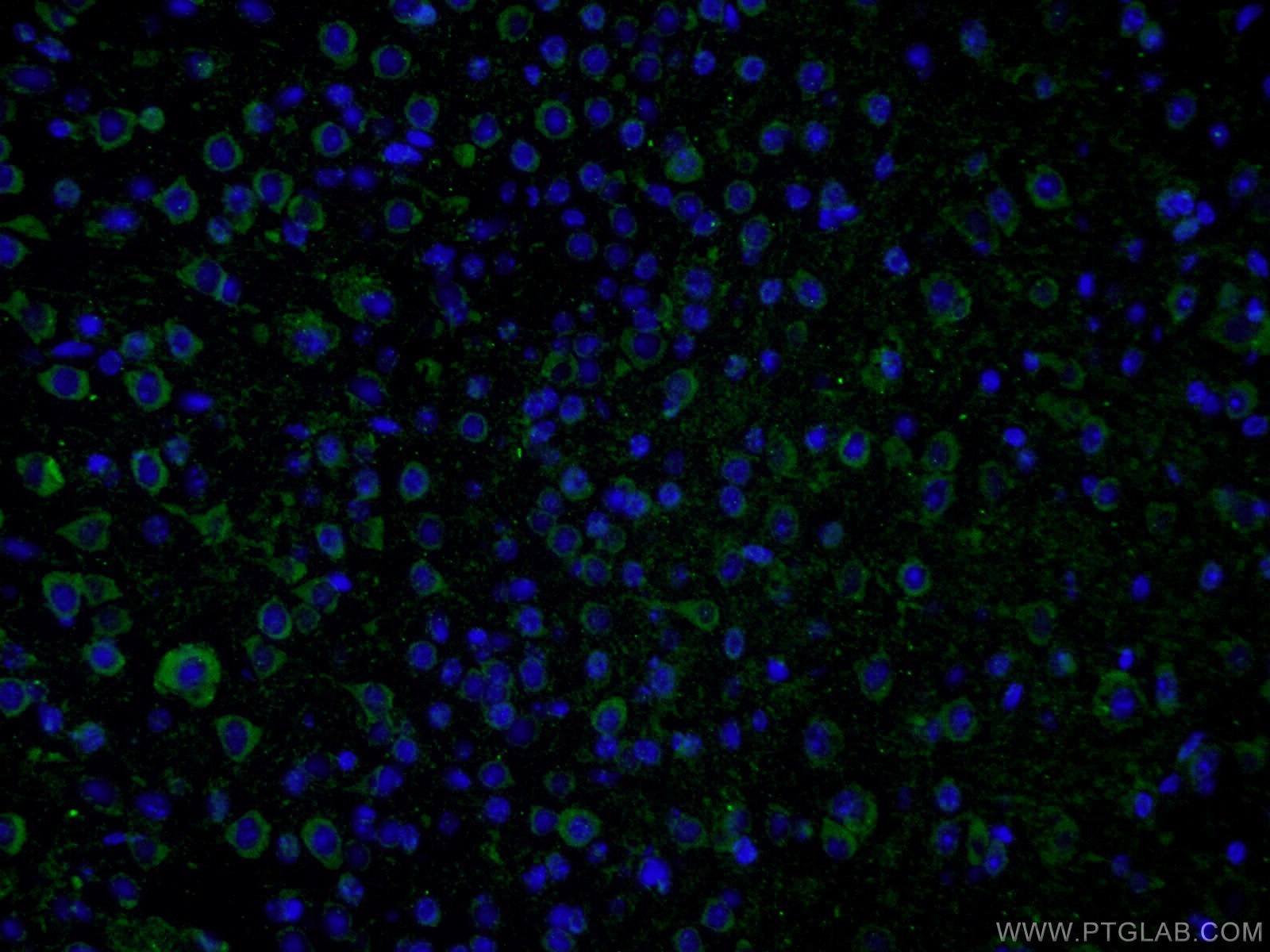 Immunofluorescence (IF) / fluorescent staining of mouse brain tissue using PHYHIPL Polyclonal antibody (16937-1-AP)