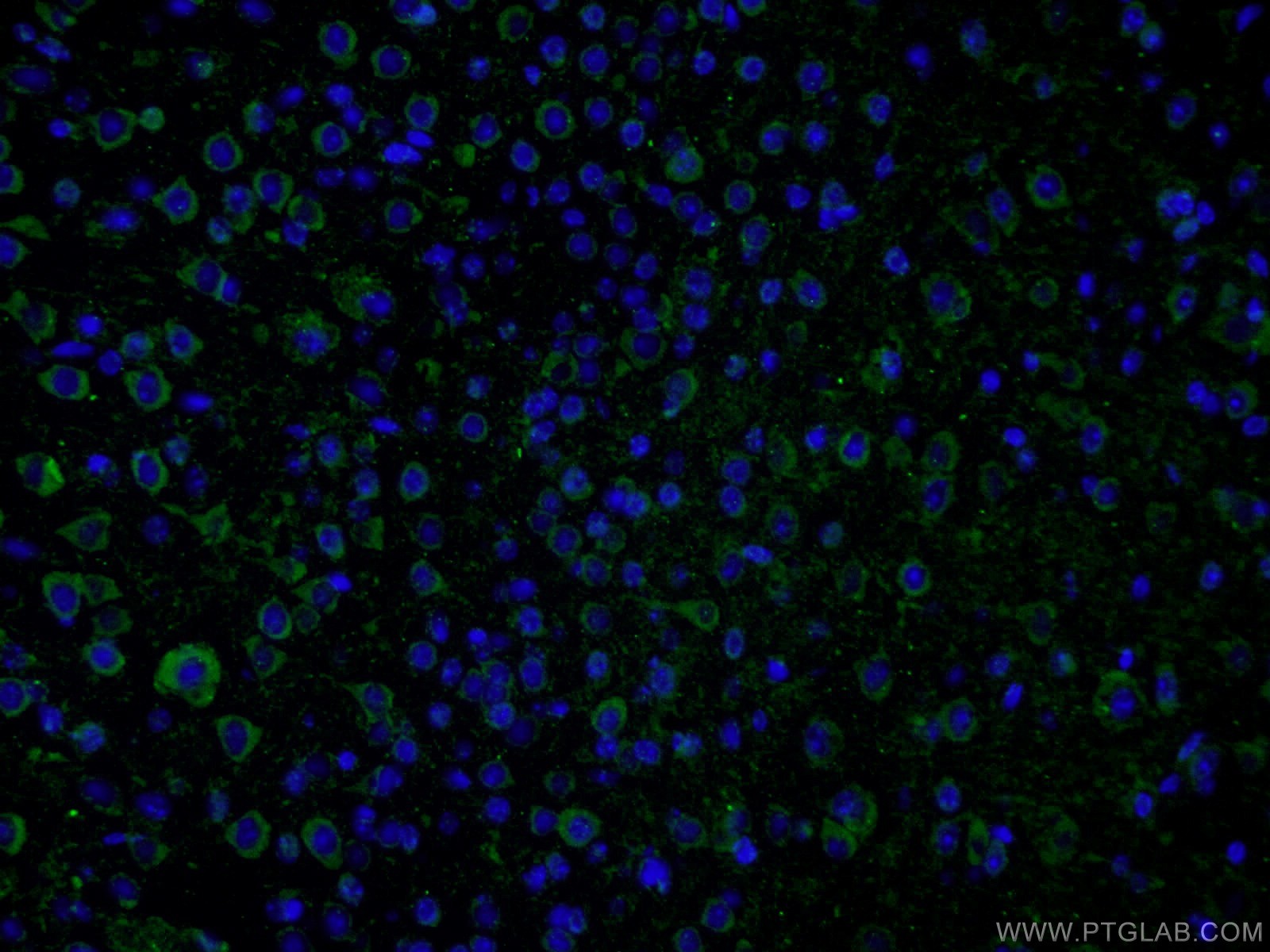 Immunofluorescence (IF) / fluorescent staining of mouse brain tissue using PHYHIPL Polyclonal antibody (16937-1-AP)