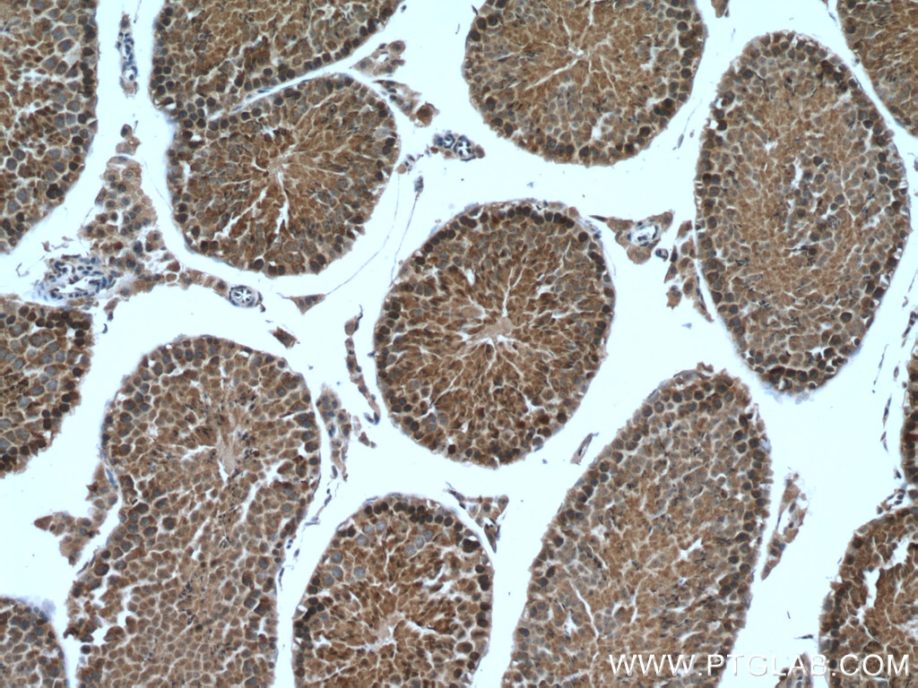 Immunohistochemistry (IHC) staining of mouse testis tissue using PHYHIPL Polyclonal antibody (16937-1-AP)
