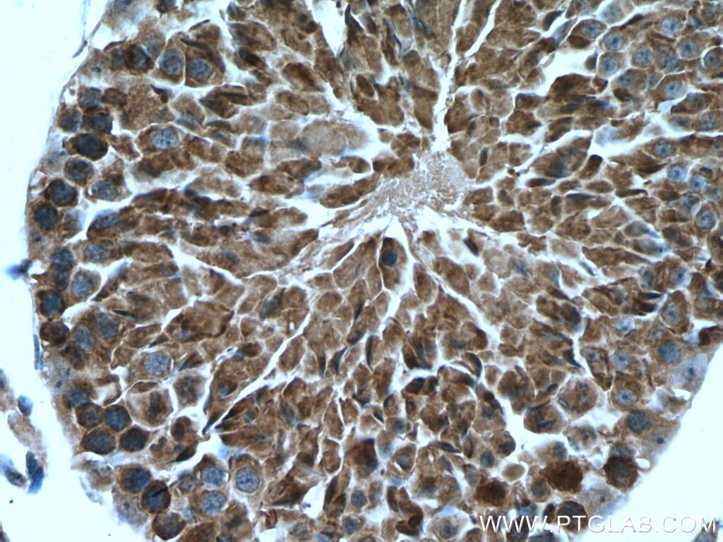 Immunohistochemistry (IHC) staining of mouse testis tissue using PHYHIPL Polyclonal antibody (16937-1-AP)