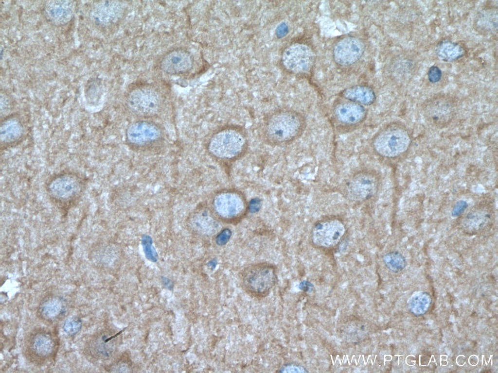Immunohistochemistry (IHC) staining of mouse brain tissue using PHYHIPL Polyclonal antibody (16937-1-AP)
