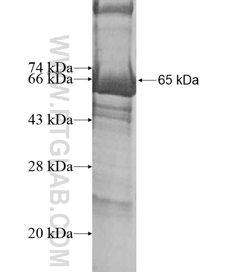 PHYHIPL fusion protein Ag10435 SDS-PAGE
