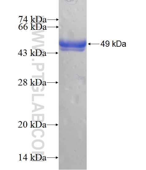 PHYHIPL fusion protein Ag10458 SDS-PAGE