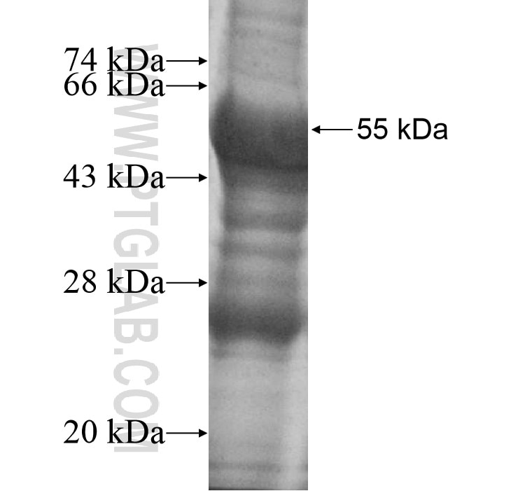 PI15 fusion protein Ag12273 SDS-PAGE