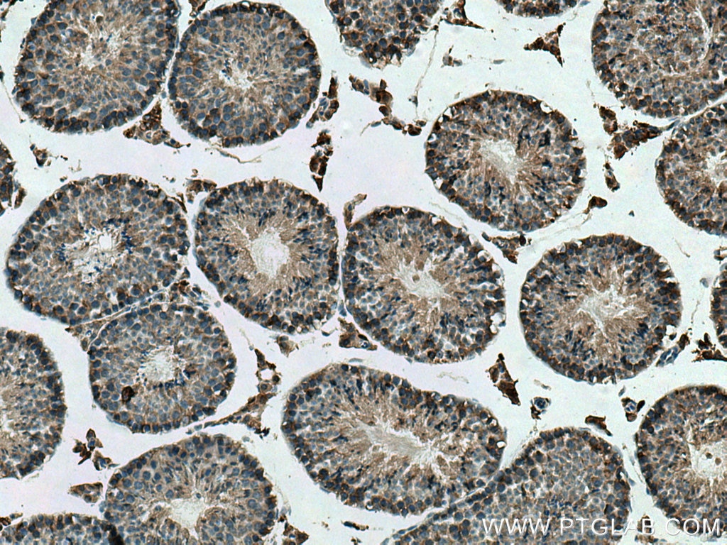 Immunohistochemistry (IHC) staining of mouse testis tissue using PI16 Polyclonal antibody (12267-1-AP)