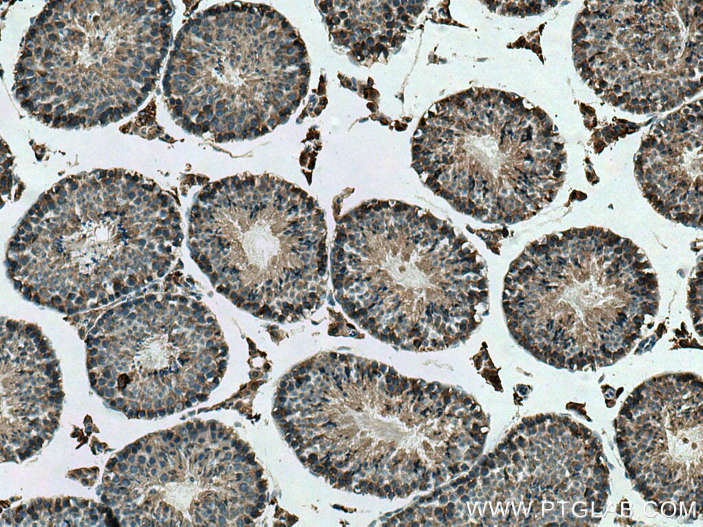 IHC staining of mouse testis using 12267-1-AP