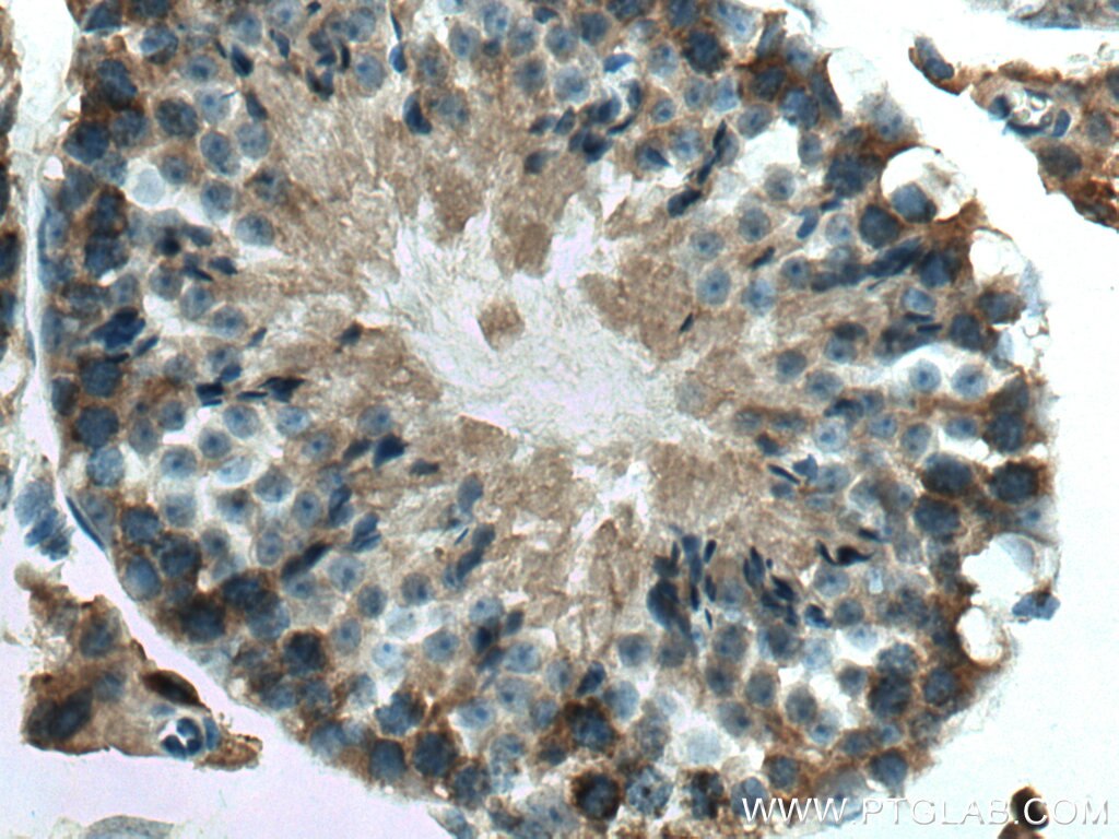 IHC staining of mouse testis using 12267-1-AP