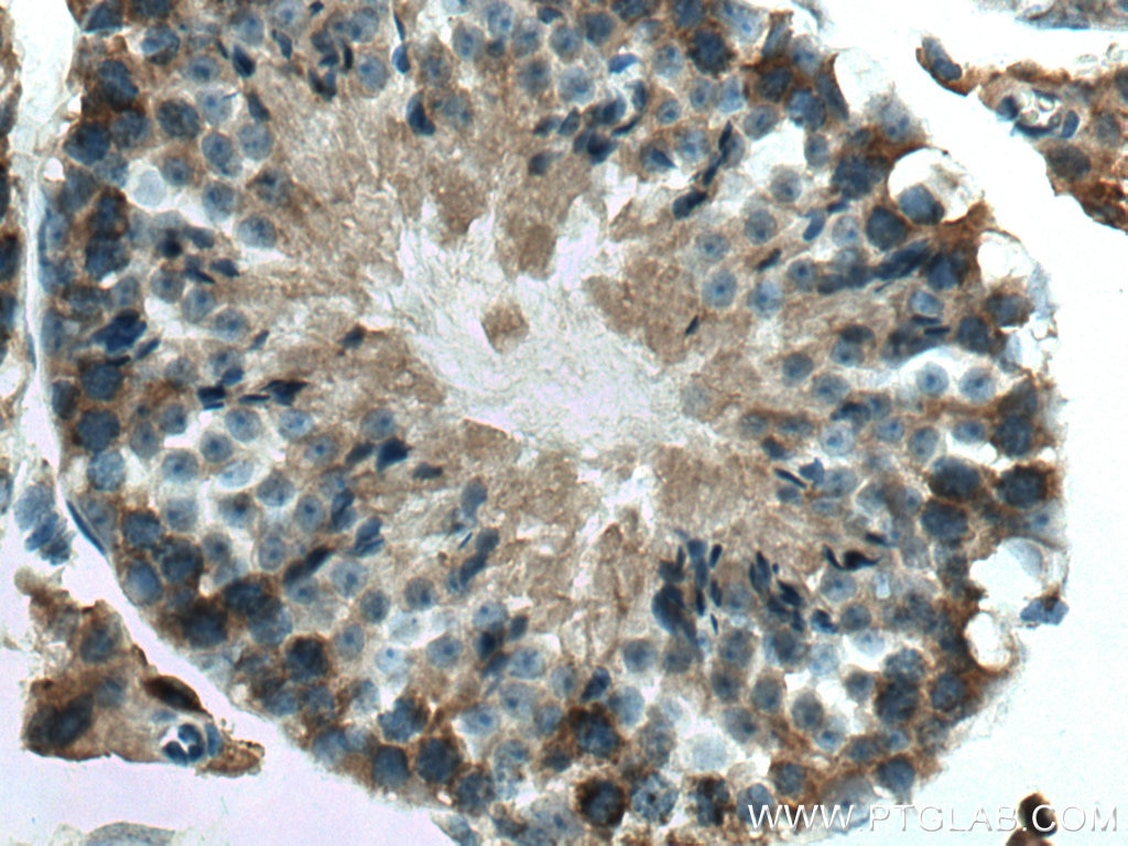 Immunohistochemistry (IHC) staining of mouse testis tissue using PI16 Polyclonal antibody (12267-1-AP)