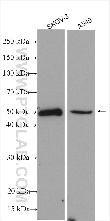 Western Blot (WB) analysis of various lysates using PI16 Polyclonal antibody (12267-1-AP)