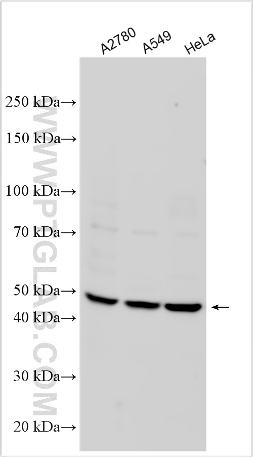 Western Blot (WB) analysis of various lysates using PI16 Polyclonal antibody (12267-1-AP)