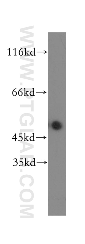 Western Blot (WB) analysis of COLO 320 cells using PI16 Polyclonal antibody (12267-1-AP)