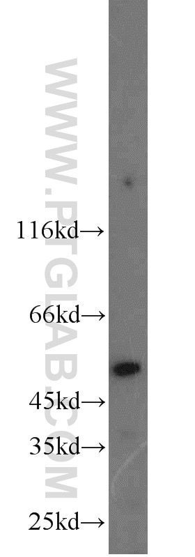 Western Blot (WB) analysis of A2780 cells using PI16 Polyclonal antibody (12267-1-AP)