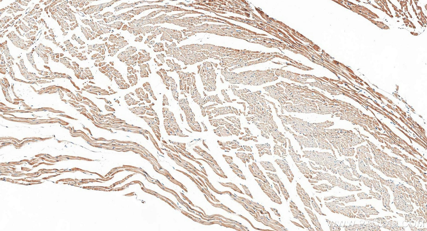 Immunohistochemistry (IHC) staining of mouse heart tissue using PI16 Polyclonal antibody (30527-1-AP)