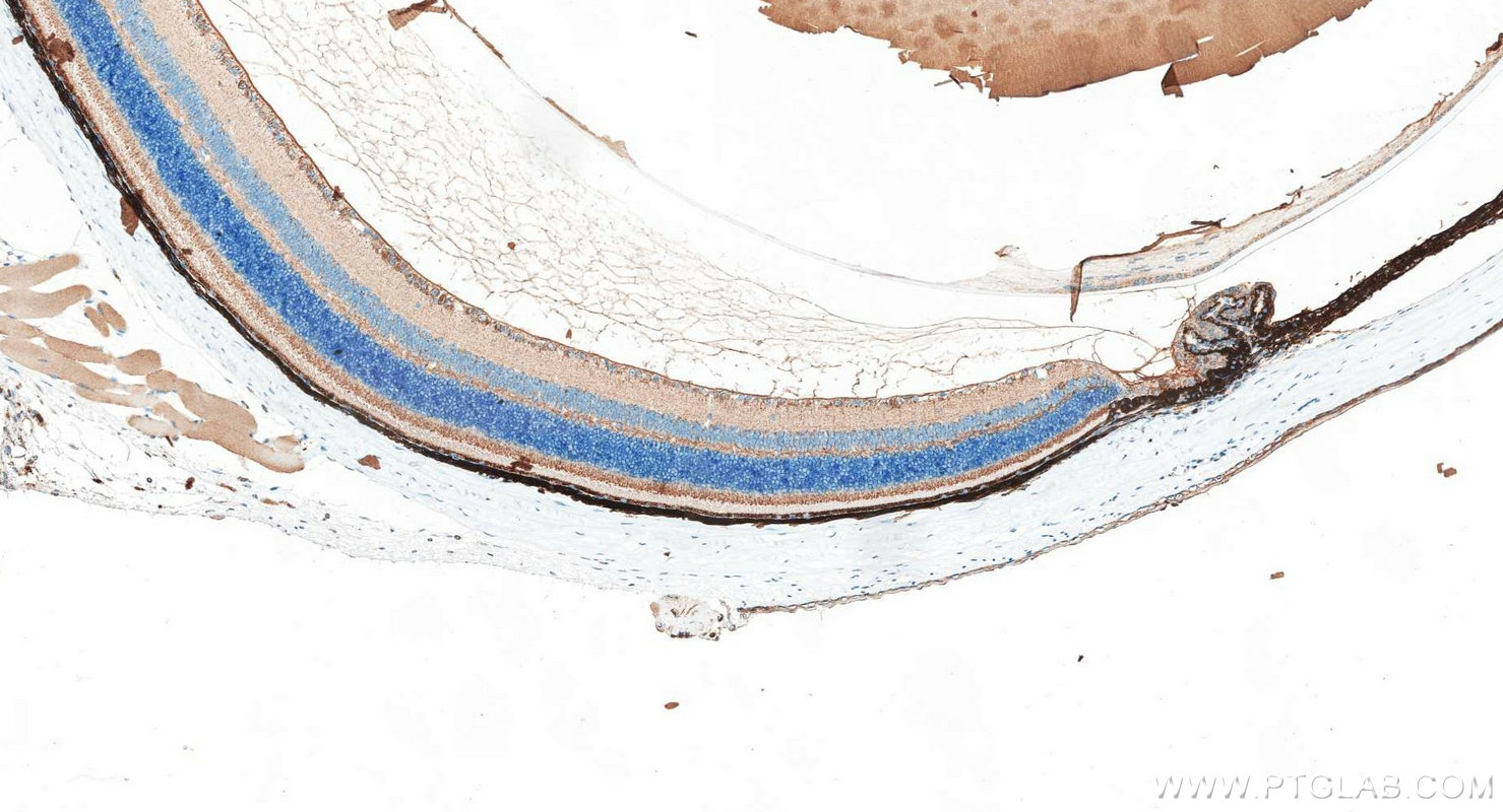Immunohistochemistry (IHC) staining of mouse eye tissue using PI16 Polyclonal antibody (30527-1-AP)