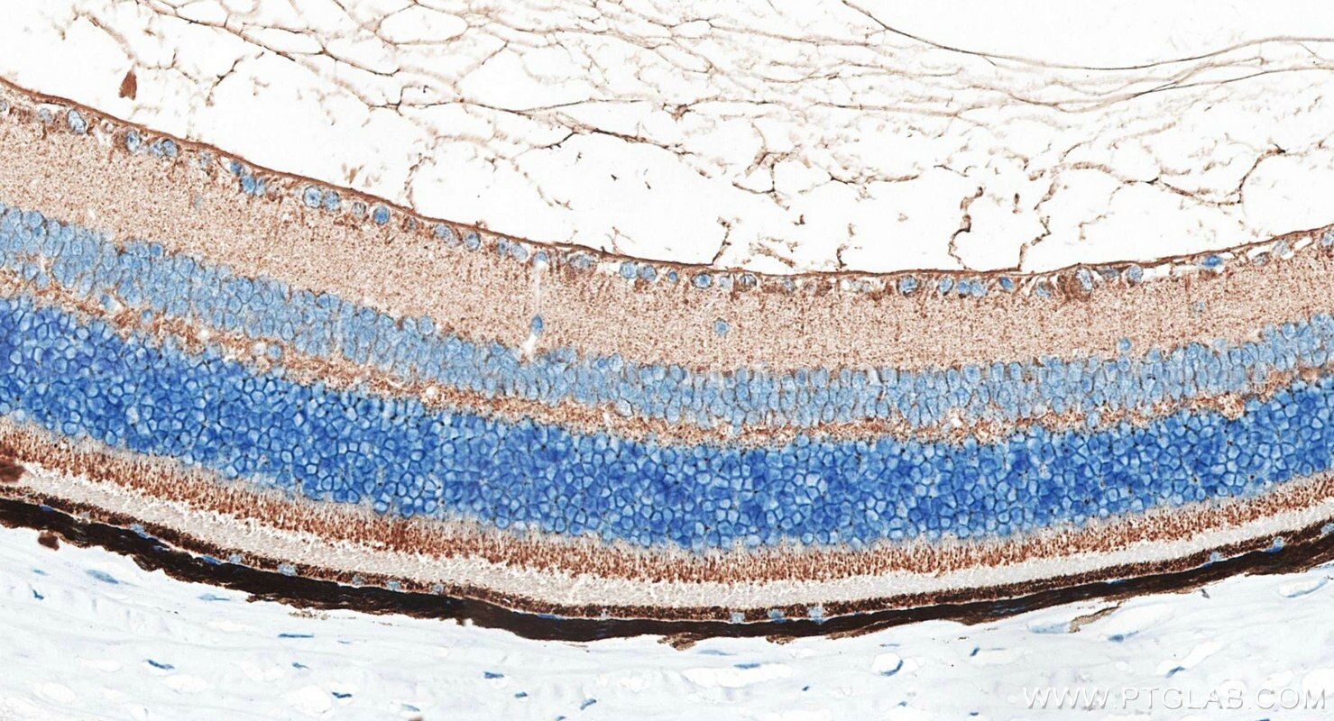 Immunohistochemistry (IHC) staining of mouse eye tissue using PI16 Polyclonal antibody (30527-1-AP)