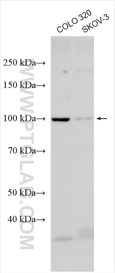 Western Blot (WB) analysis of various lysates using PI16 Polyclonal antibody (30527-1-AP)