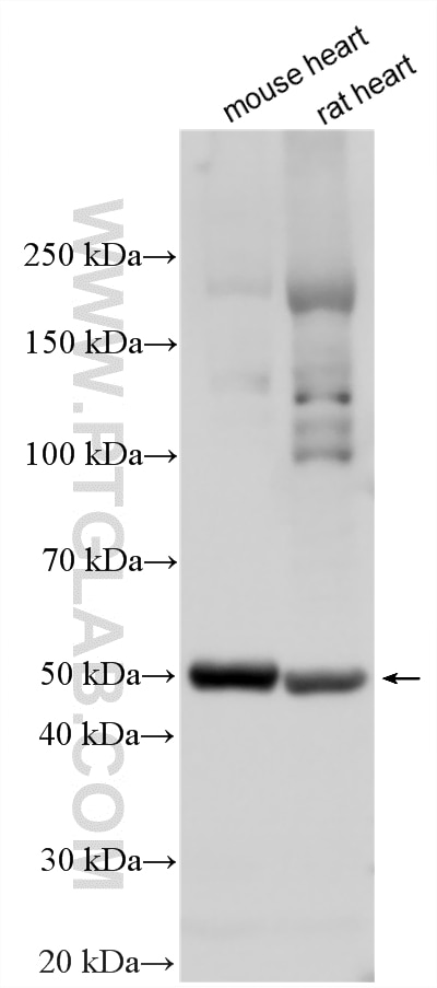 WB analysis using 30527-1-AP Western Blot (WB) analysis of various lysates using PI16 Polyclonal antibody (30527-1-AP)