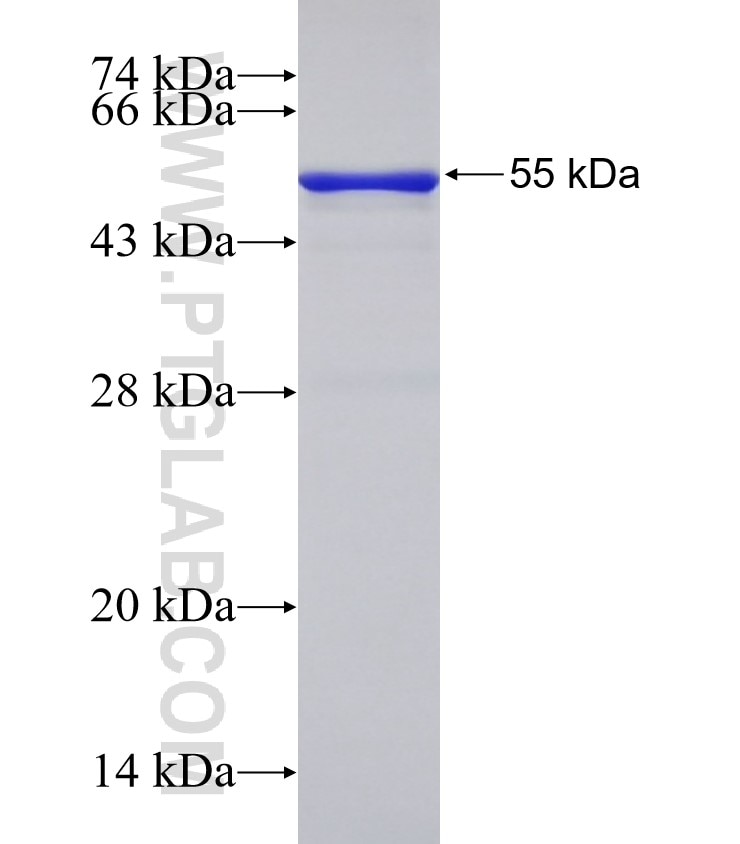 PI16 fusion protein Ag32556 SDS-PAGE