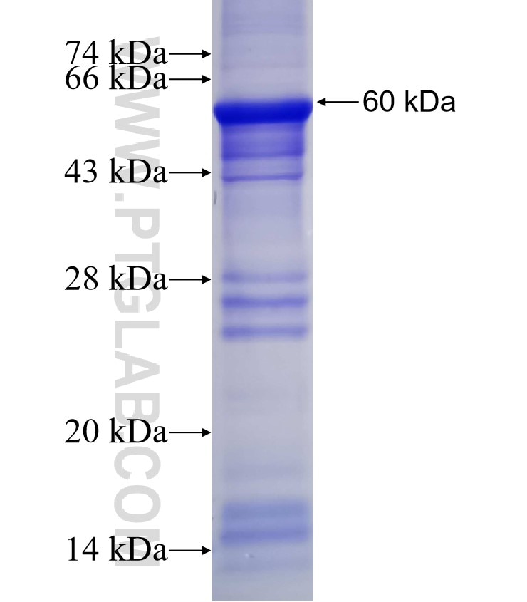 PI16 fusion protein Ag2925 SDS-PAGE
