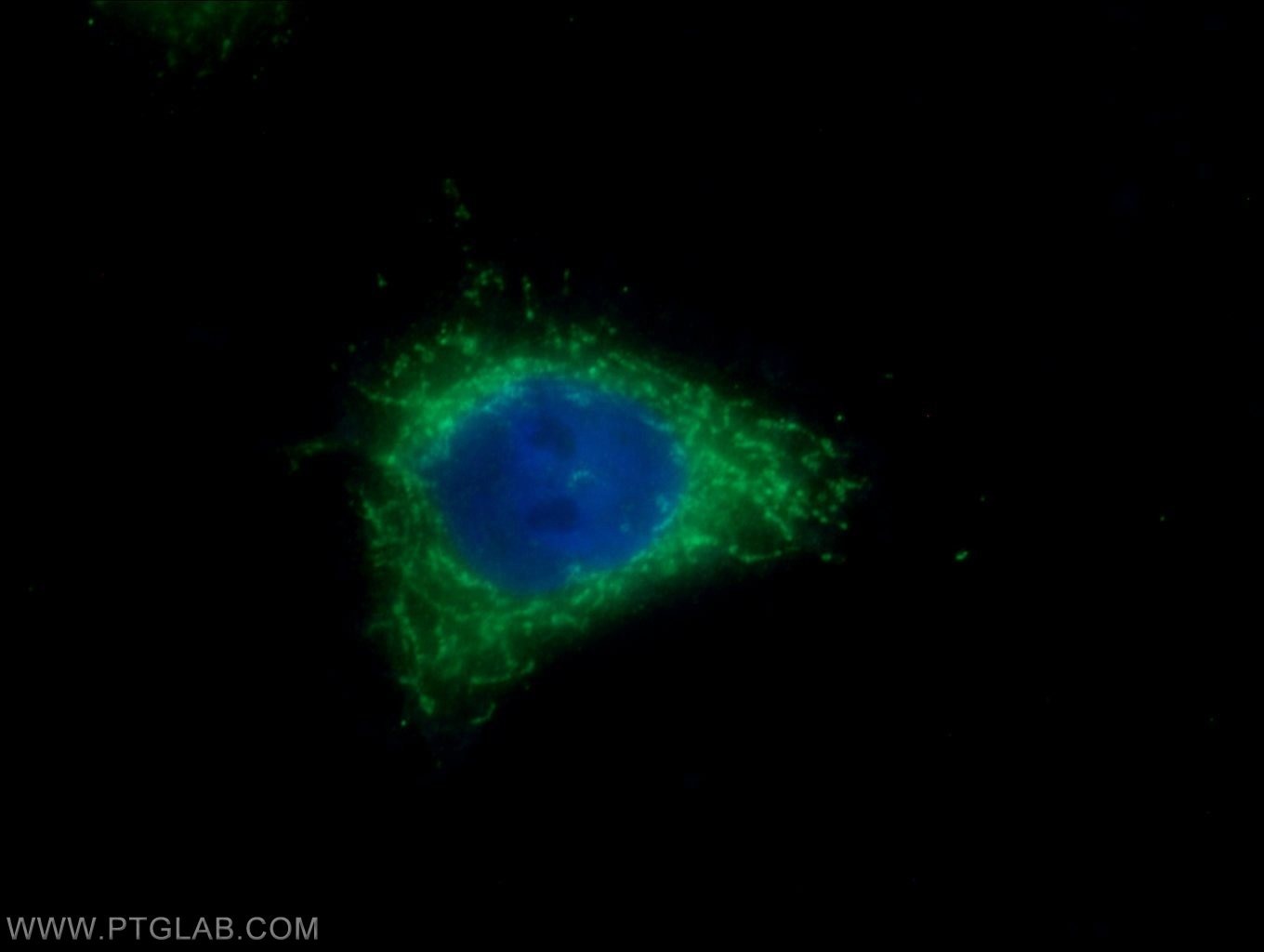 Immunofluorescence (IF) / fluorescent staining of HeLa cells using Elafin/Skalp Polyclonal antibody (15963-1-AP)