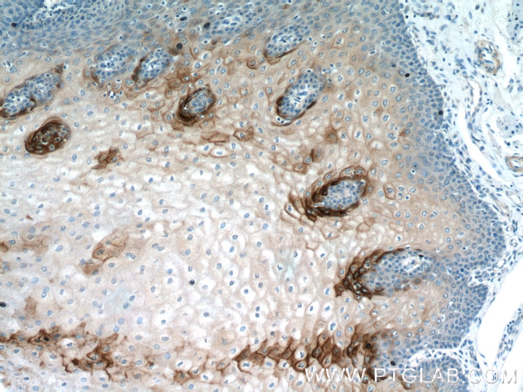 Immunohistochemistry (IHC) staining of human oesophagus tissue using Elafin/Skalp Polyclonal antibody (15963-1-AP)