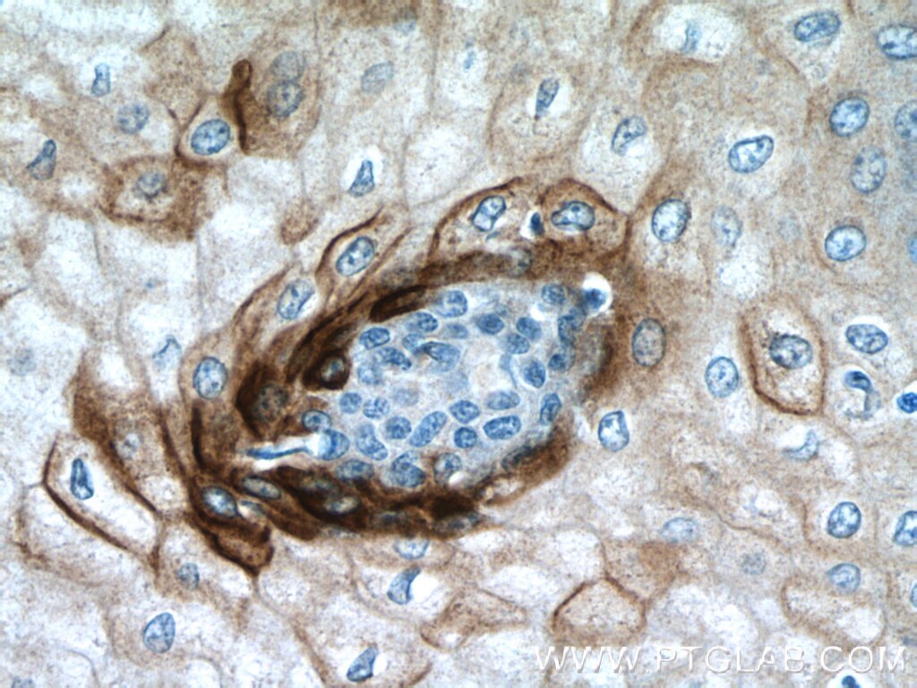 Immunohistochemistry (IHC) staining of human oesophagus tissue using Elafin/Skalp Polyclonal antibody (15963-1-AP)