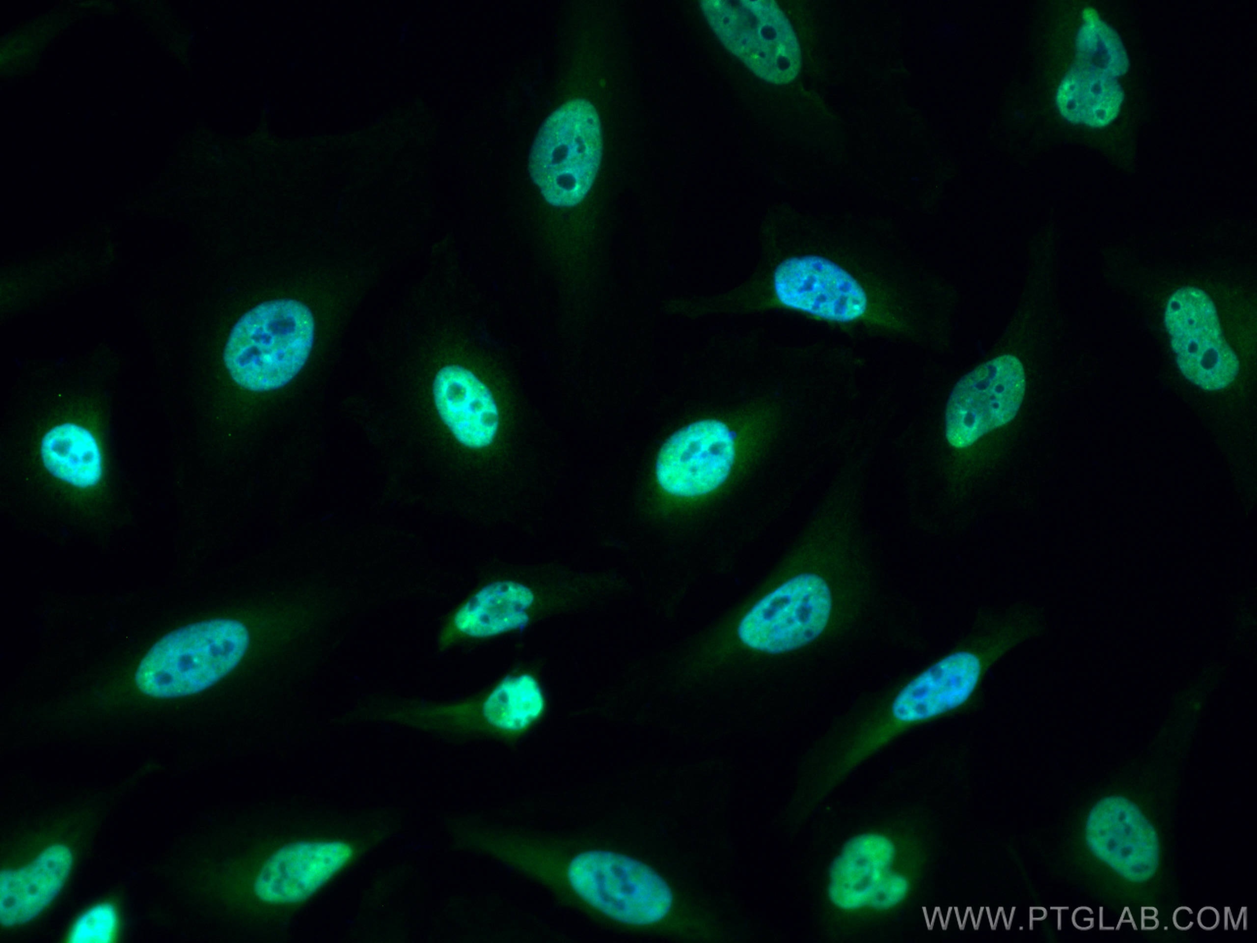 Immunofluorescence (IF) / fluorescent staining of HeLa cells using CoraLite® Plus 488-conjugated PI3 Kinase p110 Beta (CL488-20584)