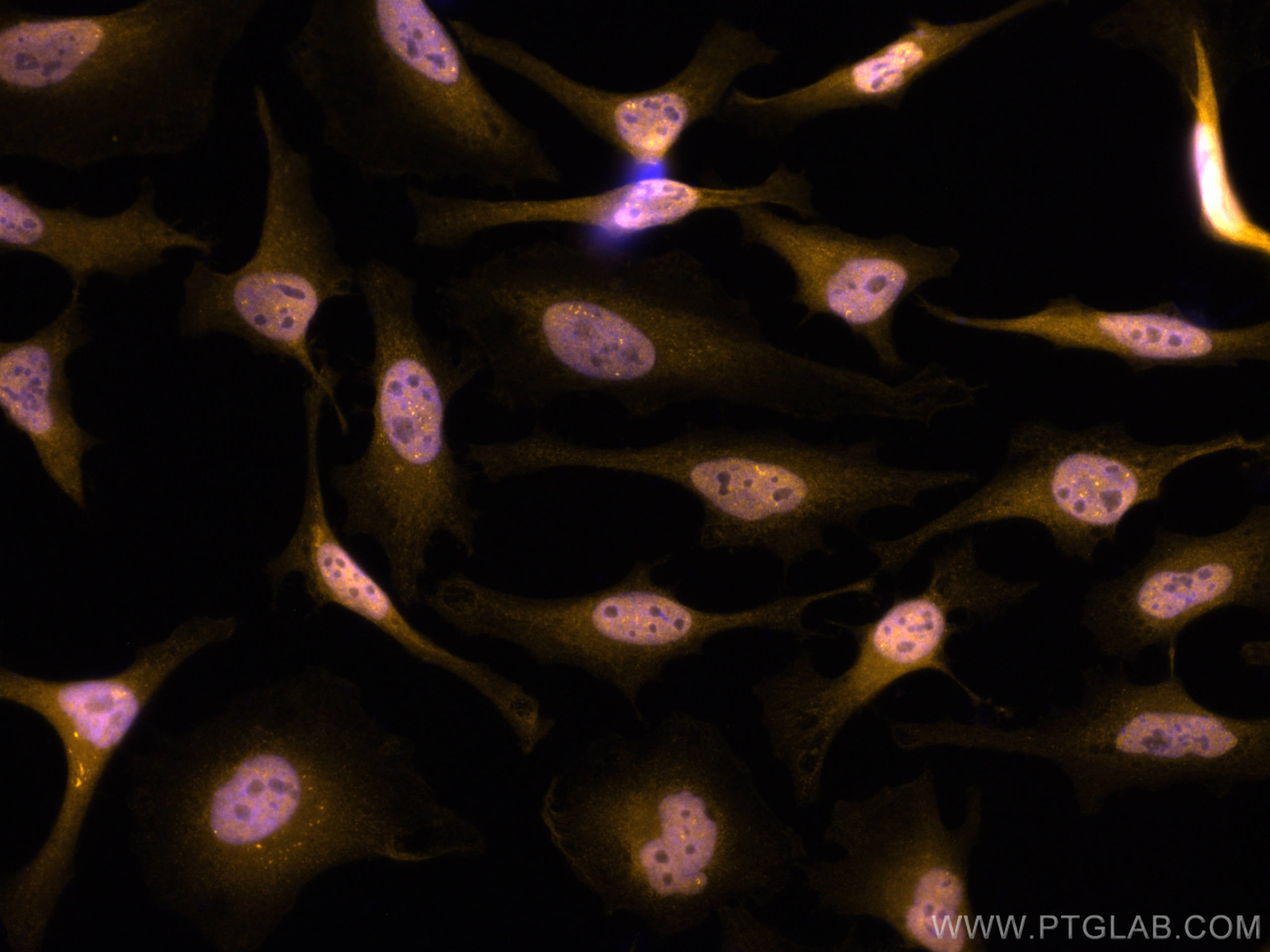 Immunofluorescence (IF) / fluorescent staining of HeLa cells using CoraLite®555-conjugated PI3 Kinase p110 Beta Polyc (CL555-20584)