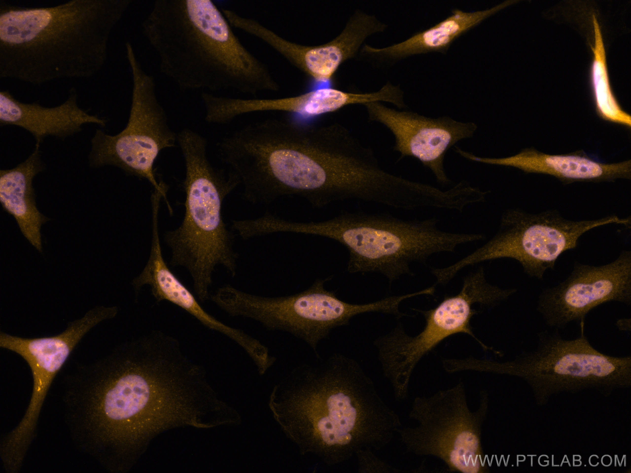 IF Staining of HeLa using CL555-20584