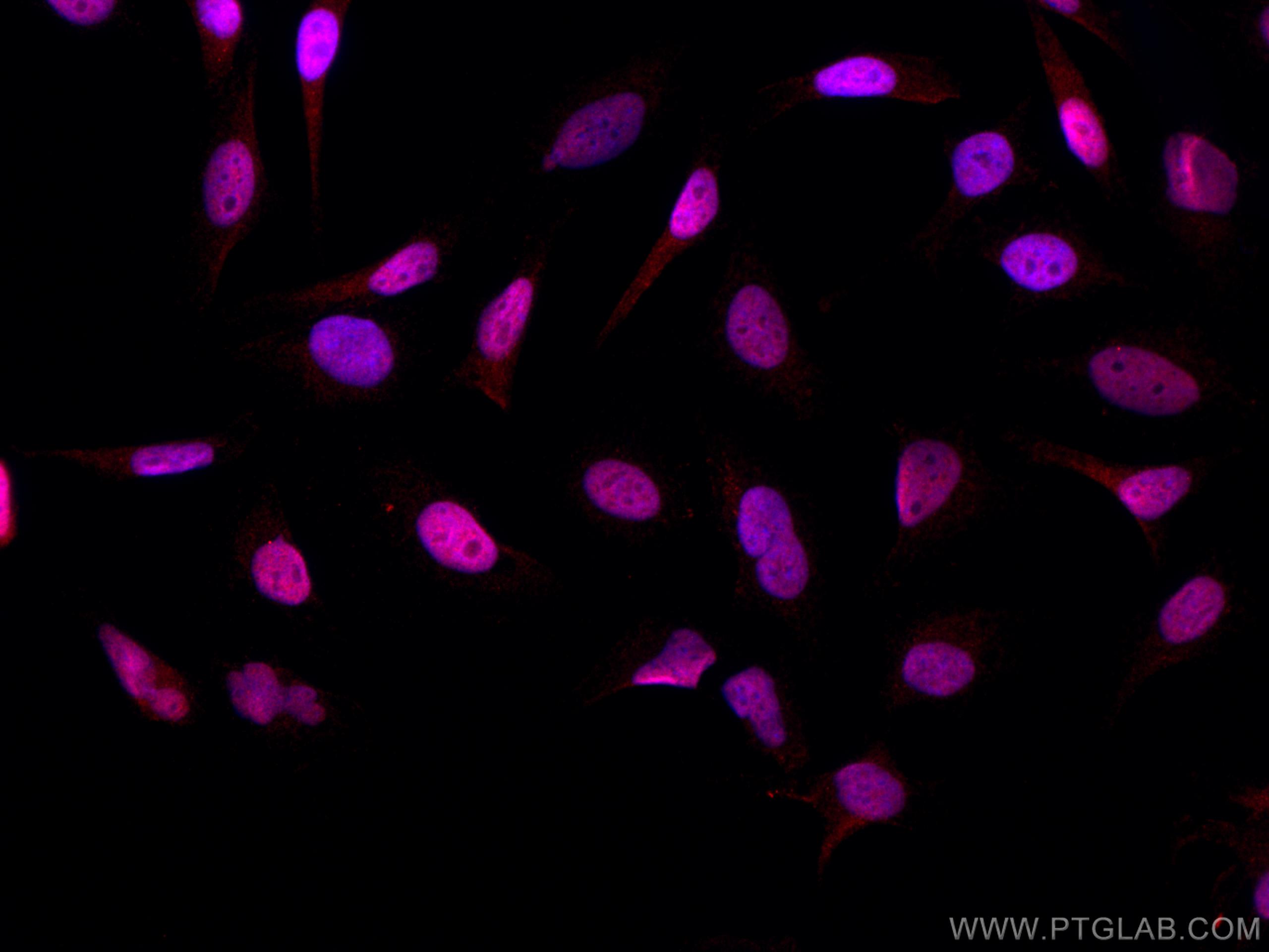 Immunofluorescence (IF) / fluorescent staining of HeLa cells using CoraLite®594-conjugated PI3 Kinase p110 Beta Monoc (CL594-67121)