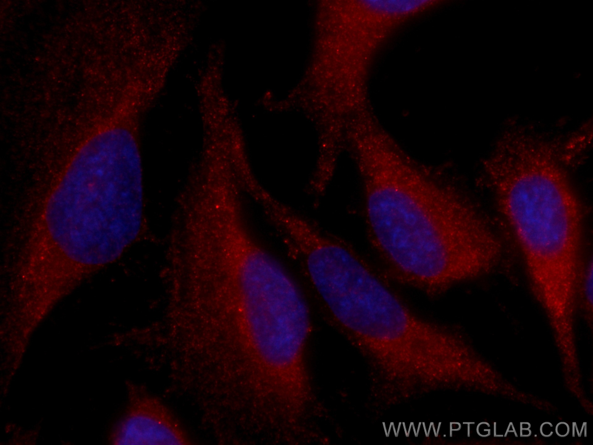 Immunofluorescence (IF) / fluorescent staining of HeLa cells using CoraLite®594-conjugated PI3 Kinase p110 Alpha Mono (CL594-67071)