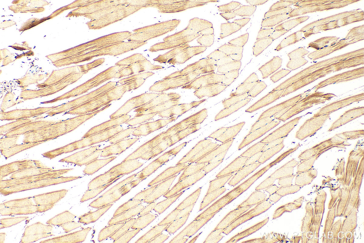 Immunohistochemistry (IHC) staining of mouse skeletal muscle tissue using PI3 Kinase p110 Gamma Polyclonal antibody (20662-1-AP)