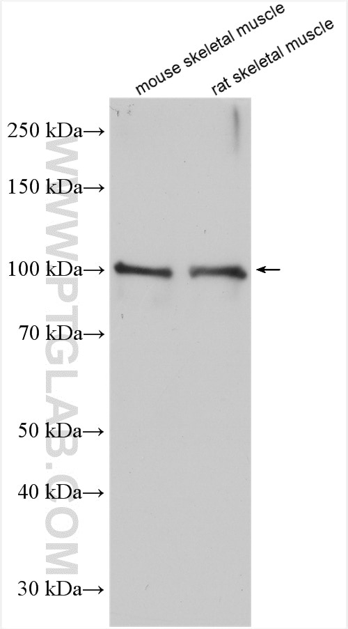 Western Blot (WB) analysis of various lysates using PI3 Kinase p110 Gamma Polyclonal antibody (20662-1-AP)