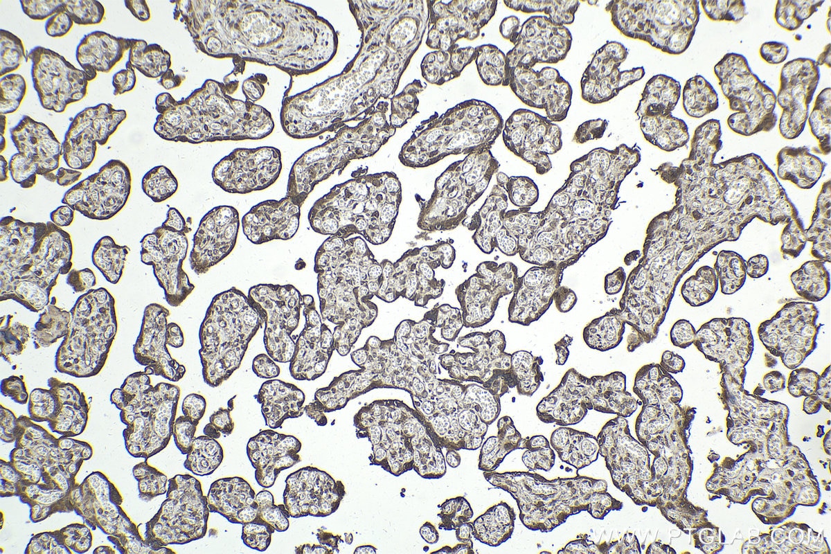 Immunohistochemistry (IHC) staining of human placenta tissue using PI3 Kinase p85 Beta Polyclonal antibody (25868-1-AP)