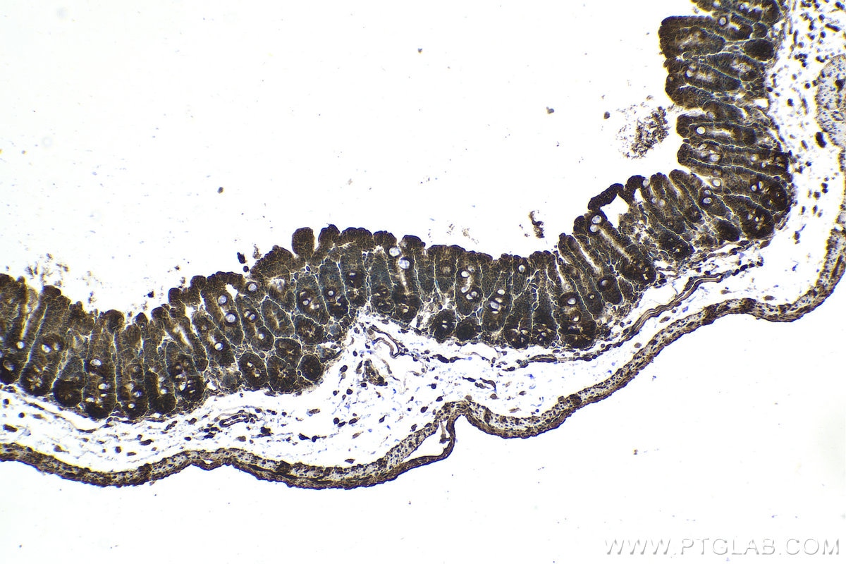 Immunohistochemistry (IHC) staining of mouse small intestine tissue using PI3 Kinase p85 Beta Polyclonal antibody (25868-1-AP)