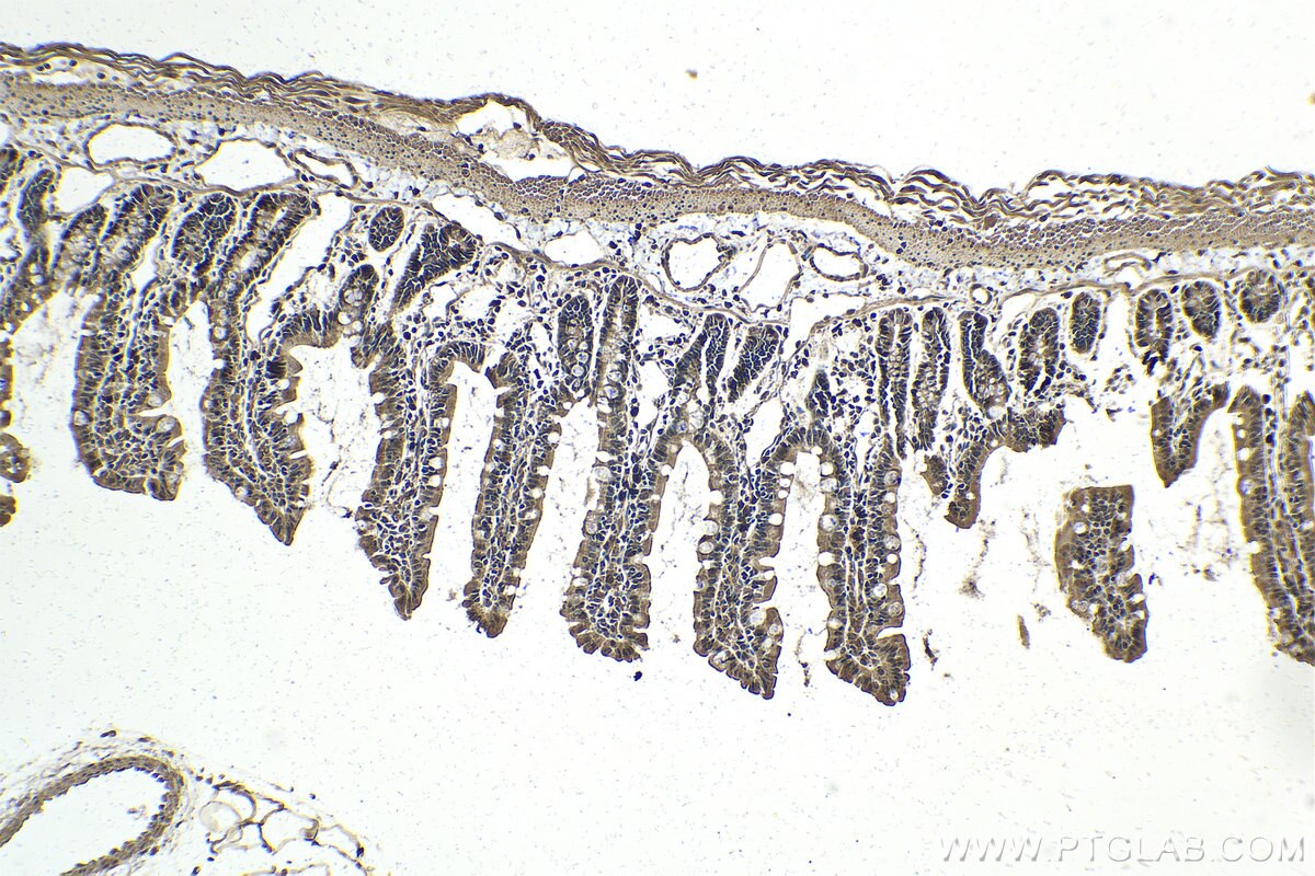 Immunohistochemistry (IHC) staining of rat small intestine tissue using PI3 Kinase p85 Beta Polyclonal antibody (25868-1-AP)