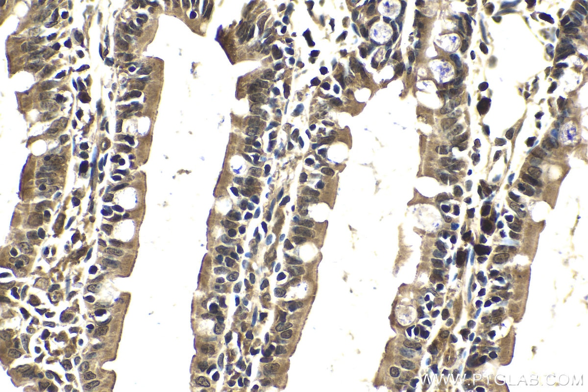 Immunohistochemistry (IHC) staining of rat small intestine tissue using PI3 Kinase p85 Beta Polyclonal antibody (25868-1-AP)