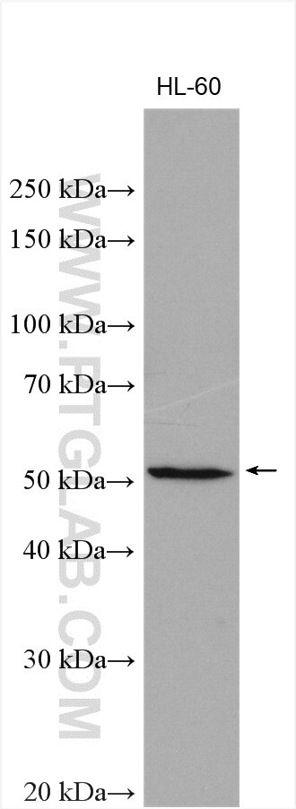 WB analysis using 15318-1-AP