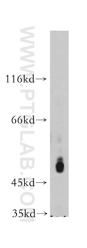 Western Blot (WB) analysis of K-562 cells using PI4K2A Polyclonal antibody (15318-1-AP)