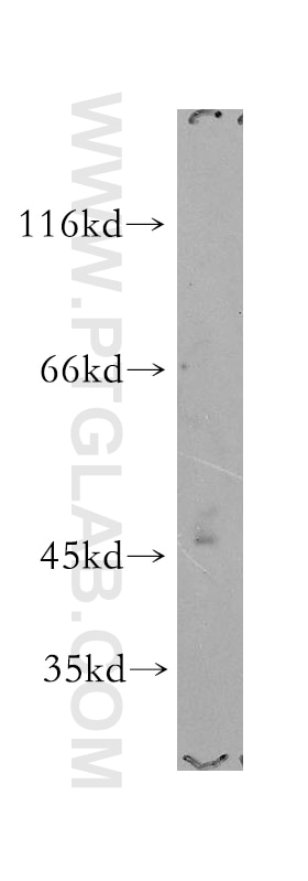 PI4K2A Polyclonal antibody