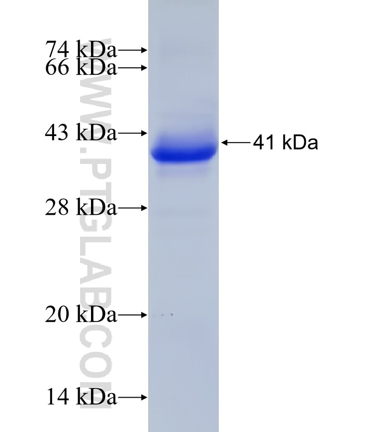 PI4K2A fusion protein Ag7845 SDS-PAGE