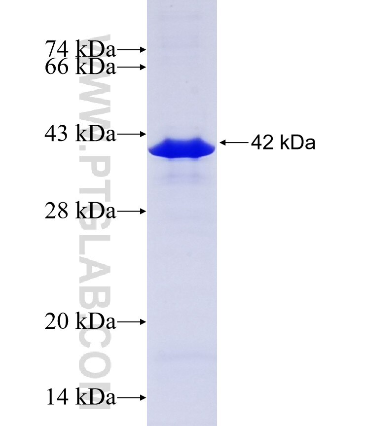 PI4K2A fusion protein Ag7845 SDS-PAGE