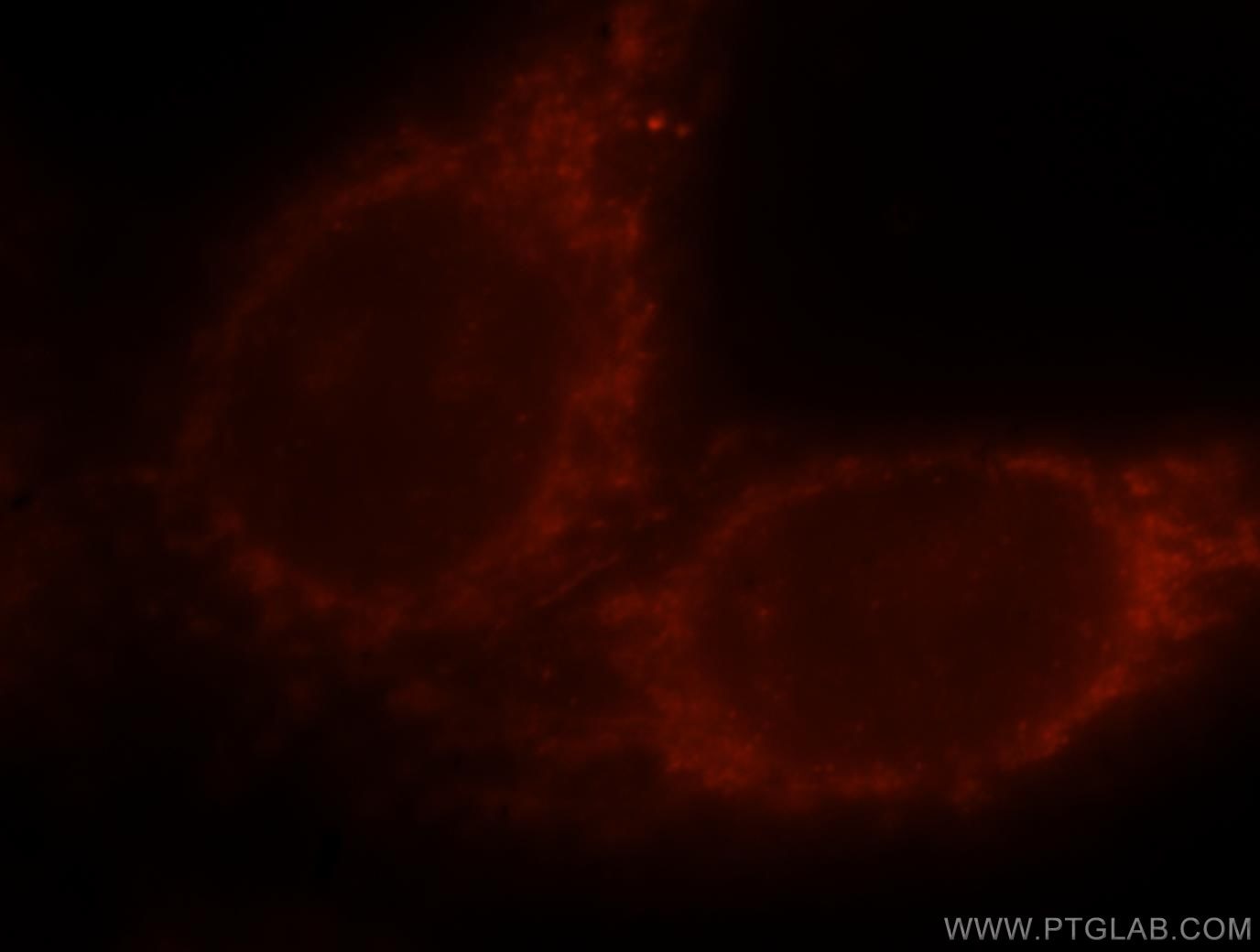 Immunofluorescence (IF) / fluorescent staining of HepG2 cells using PI4K2B Polyclonal antibody (15074-1-AP)