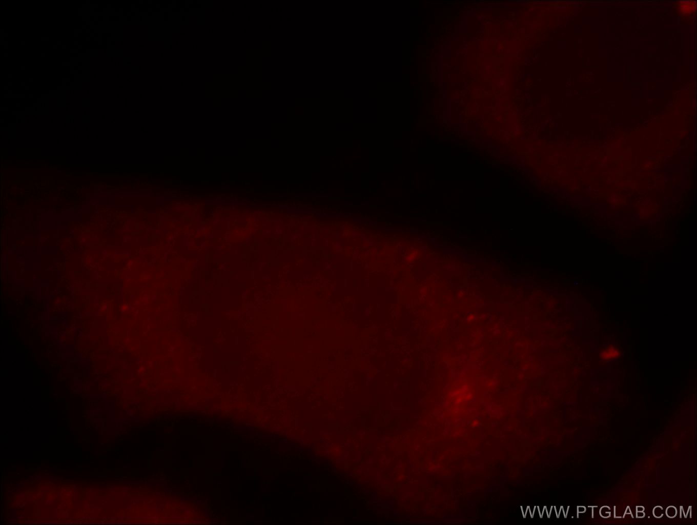 Immunofluorescence (IF) / fluorescent staining of HepG2 cells using PI4K2B Polyclonal antibody (15074-1-AP)
