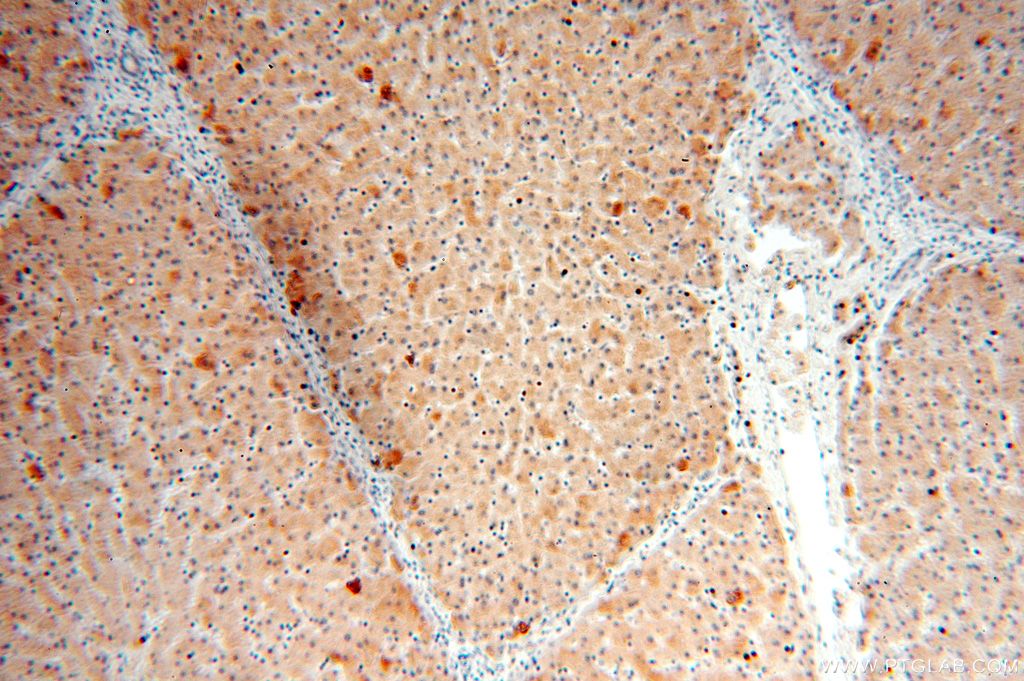 Immunohistochemistry (IHC) staining of human liver tissue using PI4K2B Polyclonal antibody (15074-1-AP)