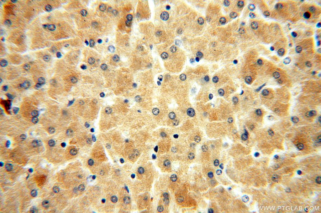 Immunohistochemistry (IHC) staining of human liver tissue using PI4K2B Polyclonal antibody (15074-1-AP)