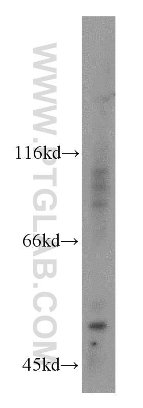 Western Blot (WB) analysis of mouse kidney tissue using PI4K2B Polyclonal antibody (15074-1-AP)